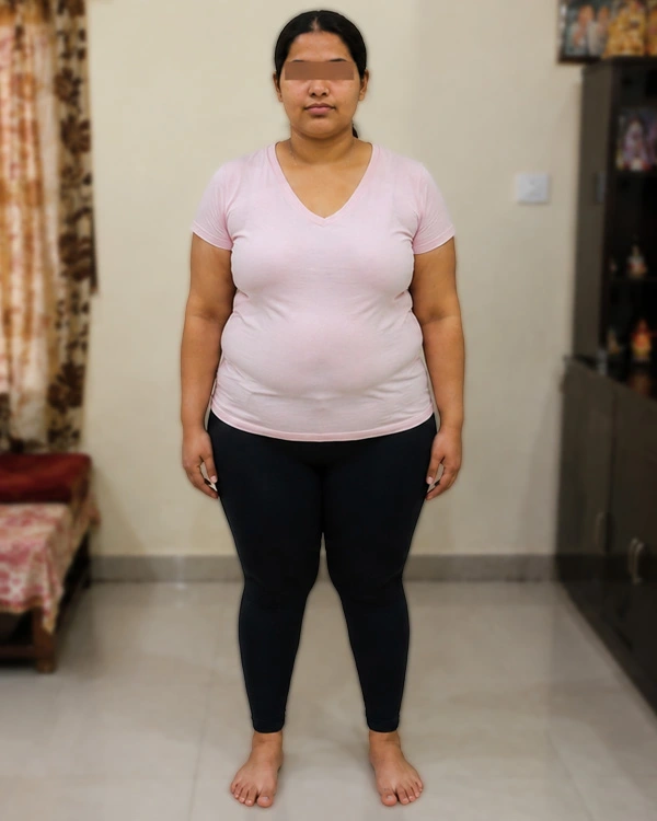 Obesity management before result